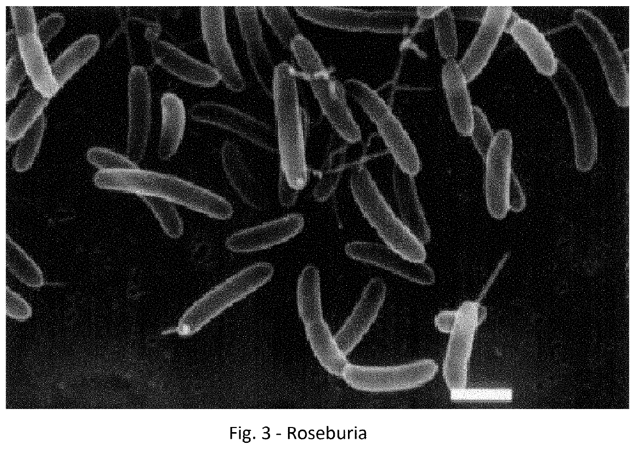 Method for Reducing the Likelihood of Developing Bladder or Colorectal Cancer in an Individual Human Being