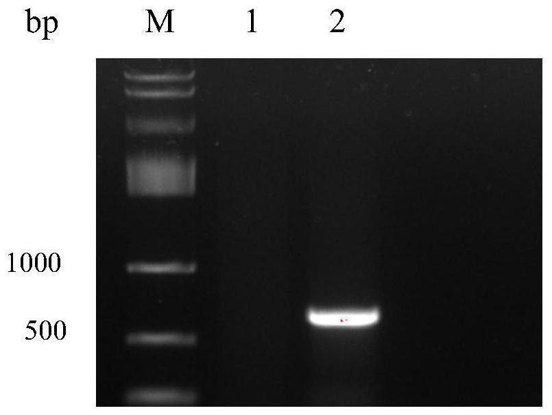 Schizochytrium sp. genetic engineering strain overexpressing squalene synthetase gene, as well as construction method and application of schizochytrium sp. genetic engineering strain