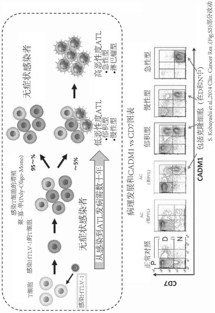 Adult t-cell leukemia-lymphoma detection method