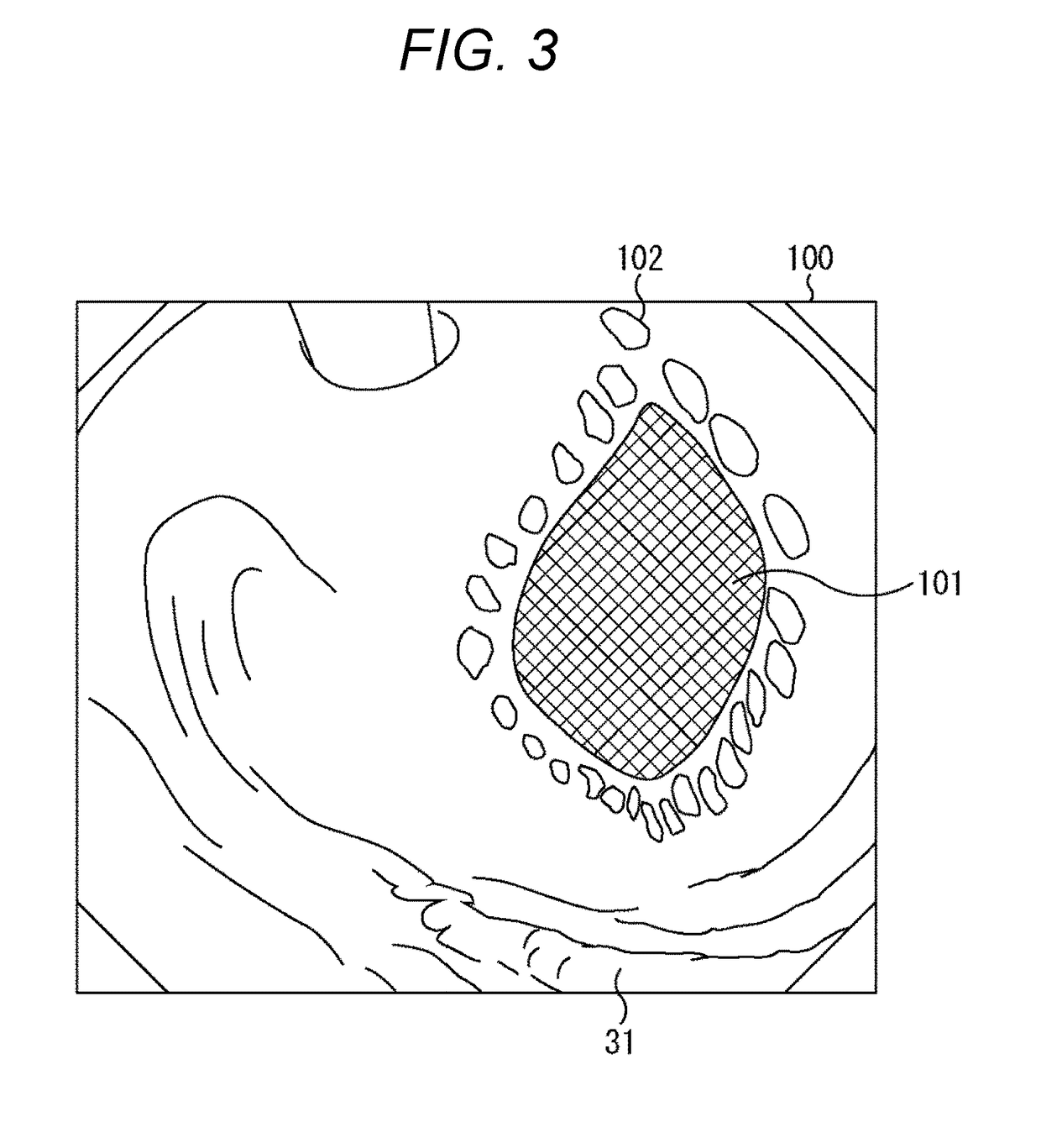 Image processing device, image processing method, and surgical system