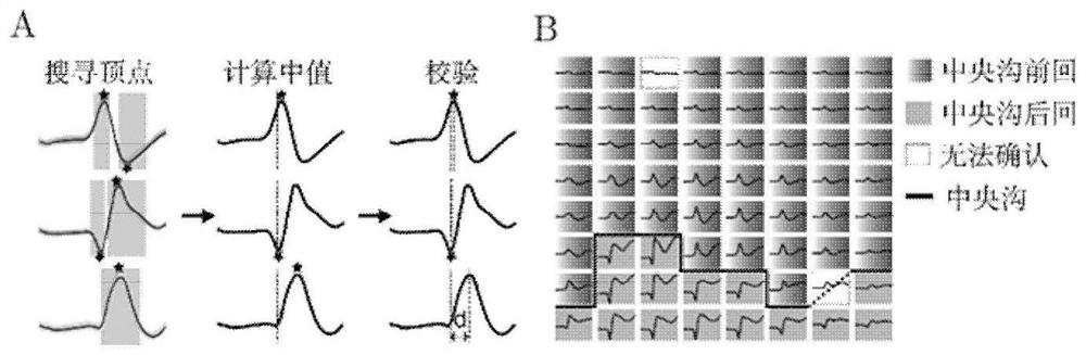 A brain function localization method based on cortical electroencephalography under median nerve electrical stimulation