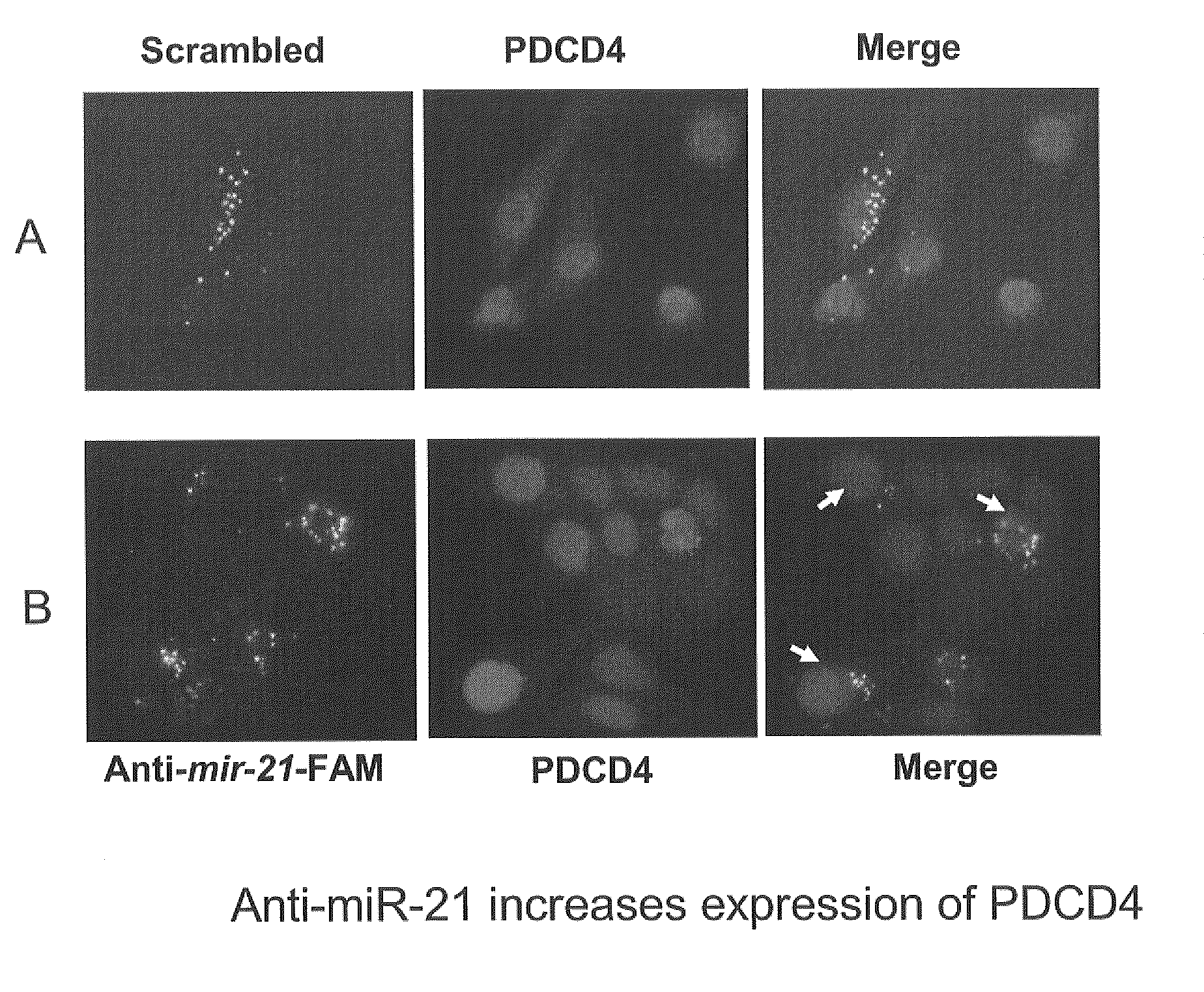 GENETIC SELECTION SYSTEM FOR IDENTIFICATION OF MicroRNA TARGET GENES