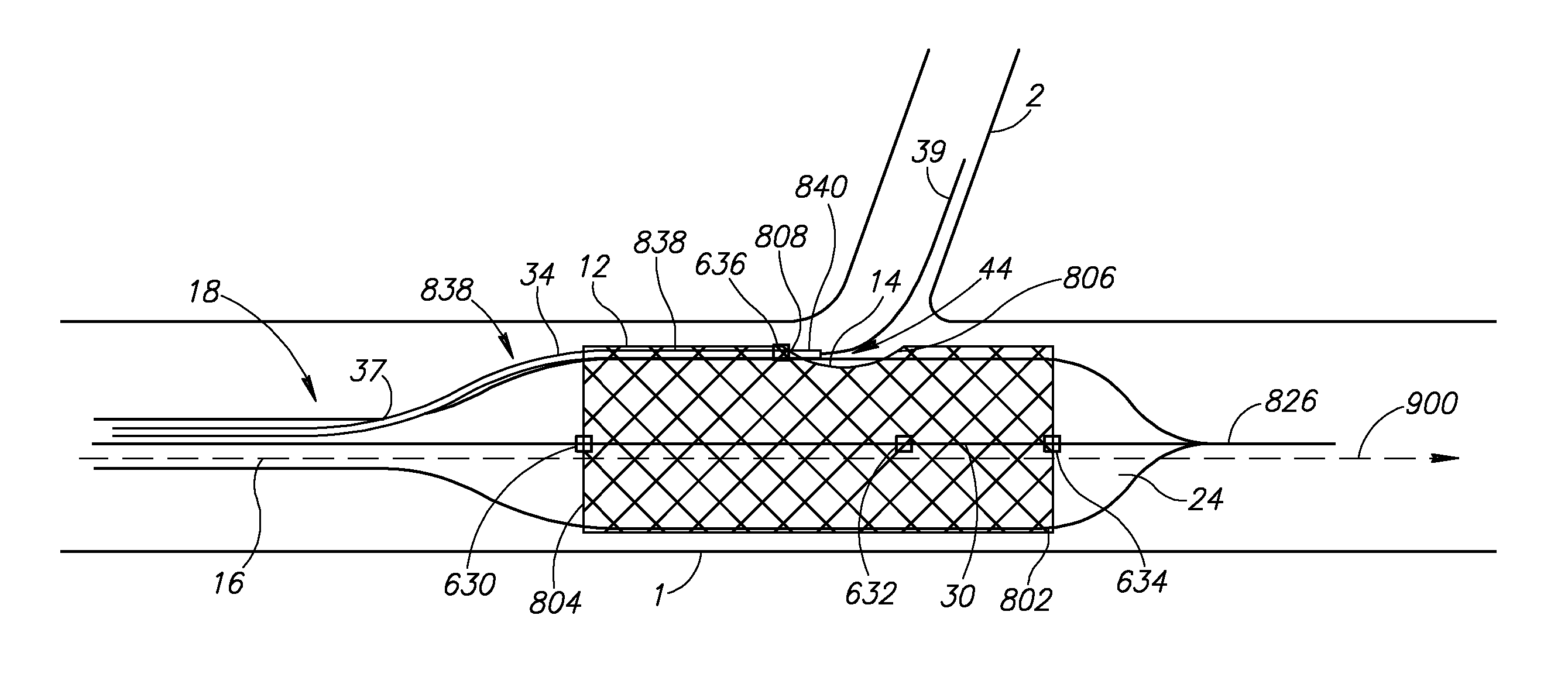 Vessel treatment devices