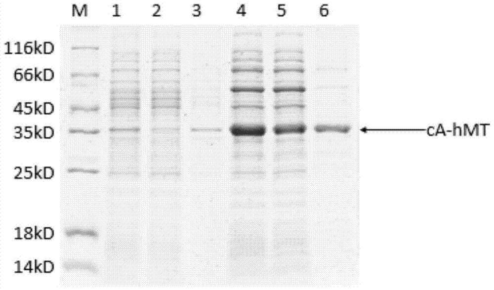 A food-grade Lactococcus lactis with surface-anchored human I-type metallothionein and its preparation method and application