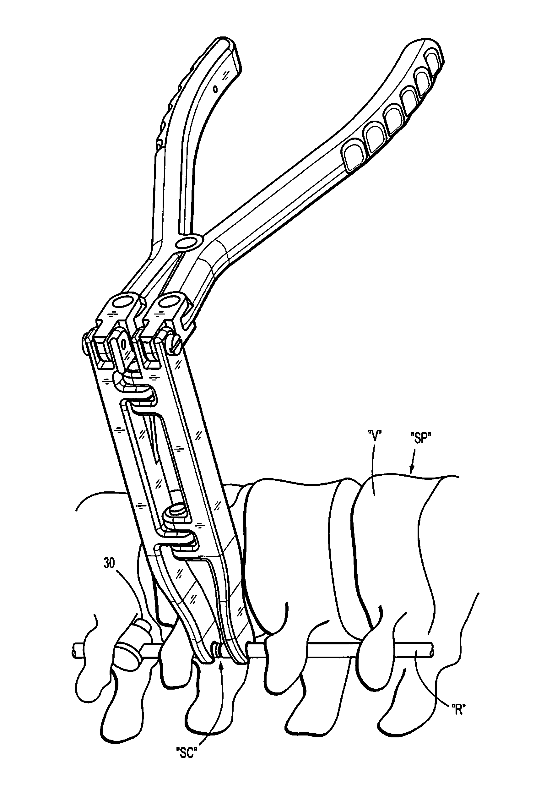 Surgical rod scorer and method of use of the same