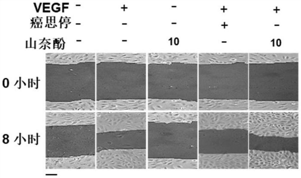 Application of kaempferol and its analogs