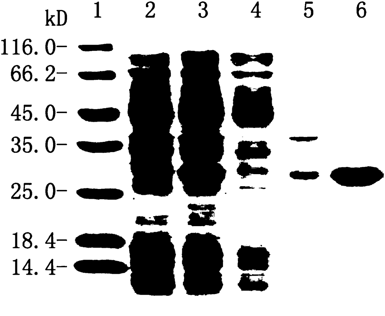 Pneumococcus combined vaccine using recombinant vector protein and preparation method of pneumococcus combined vaccine
