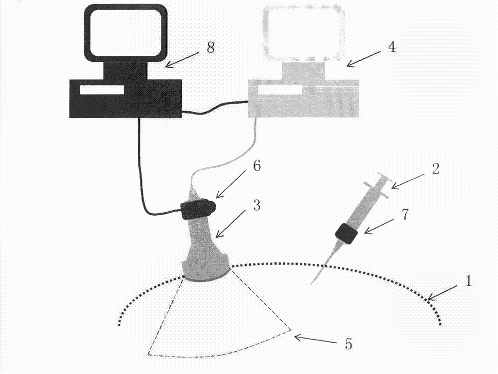 Aided navigation system and method of puncture operation under ultrasonic image