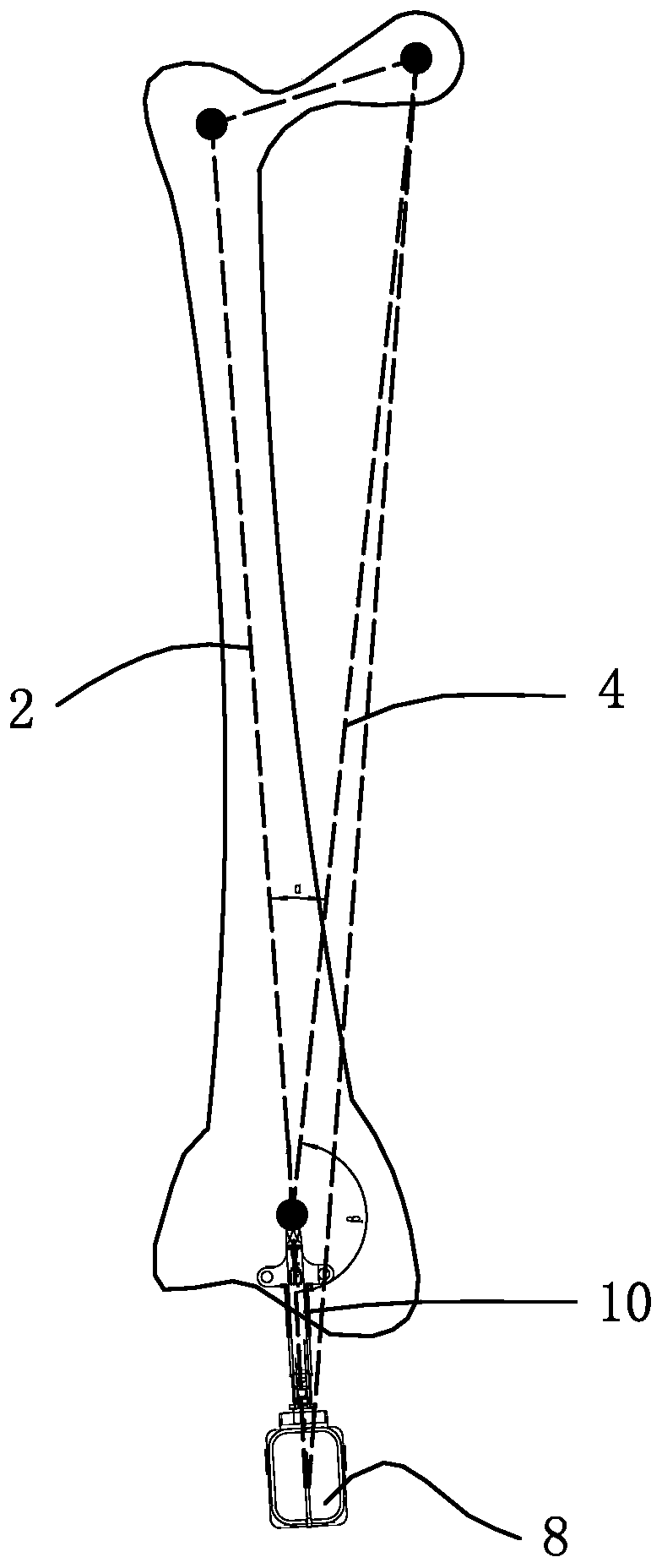 Joint replacement surgery auxiliary positioning method and system based on inertia navigation