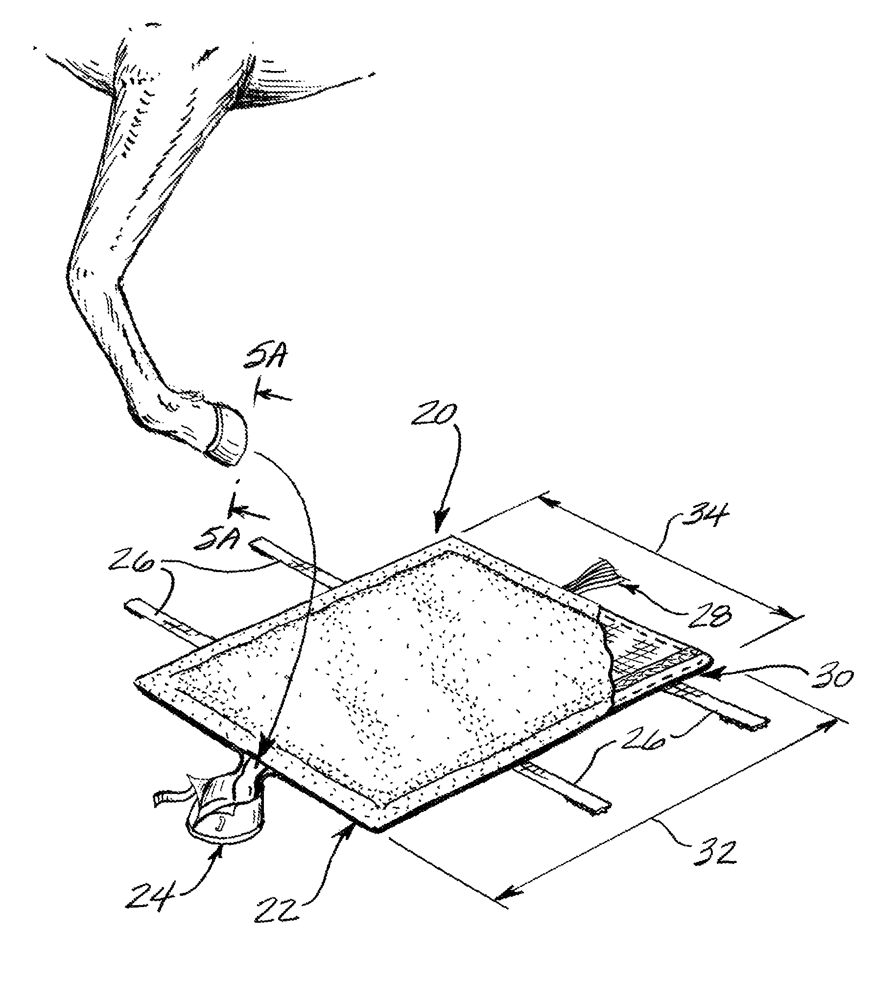 Laminitis treatment system and method