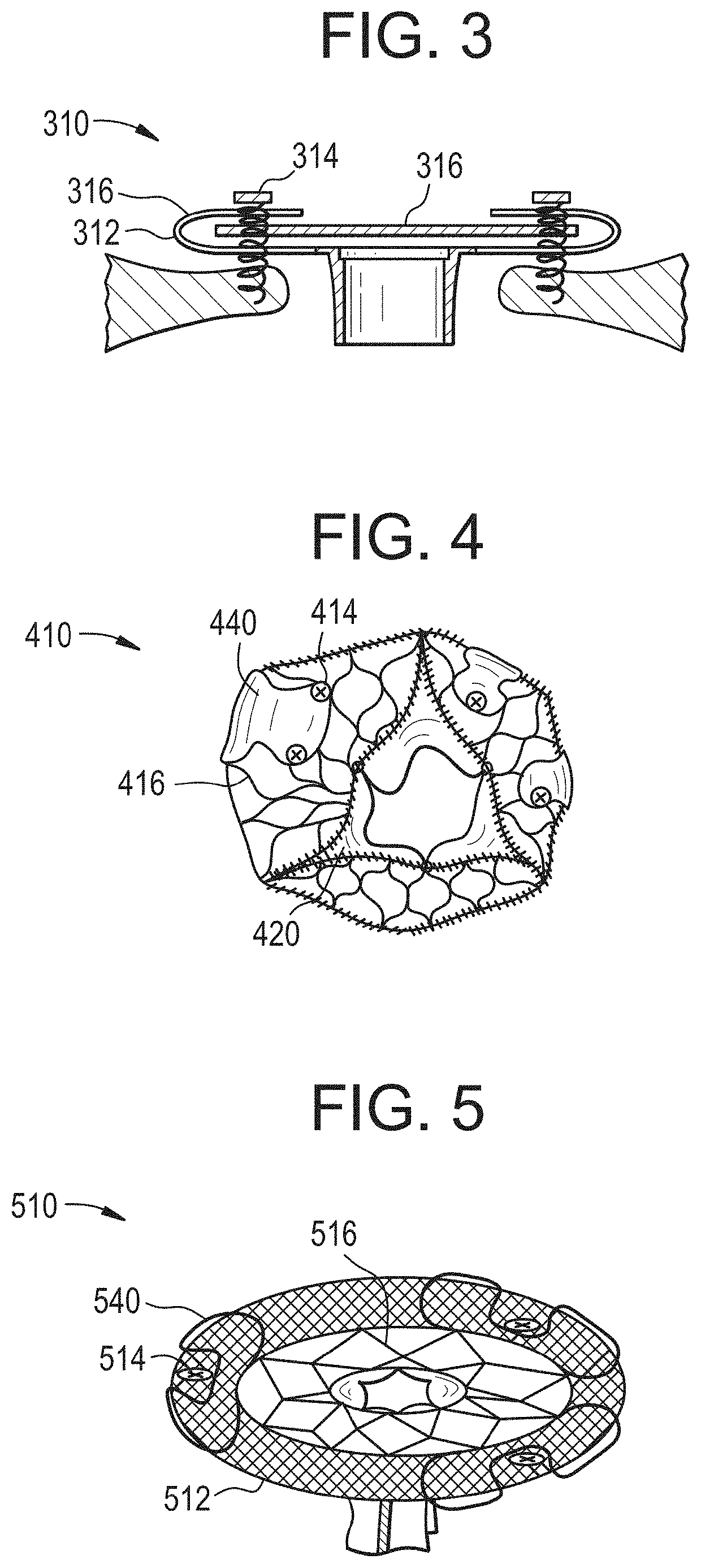 Devices and methods for anchoring transcatheter heart valve