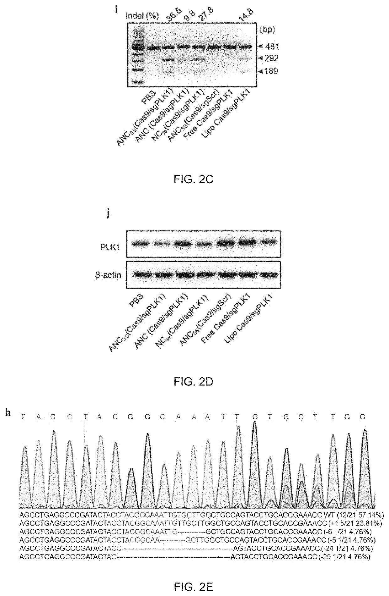 Gene Editing Nanocapsule and Preparation Method and Use Thereof