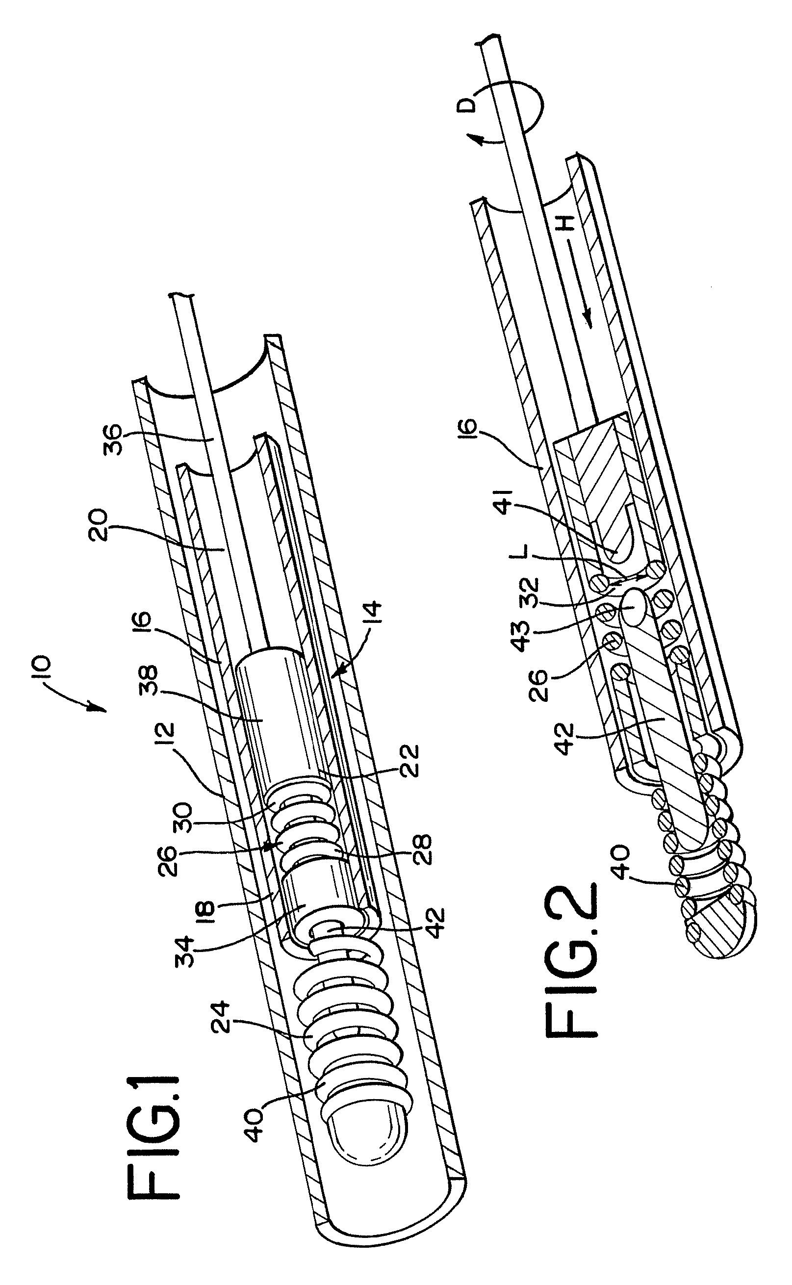 Embolic device delivery system