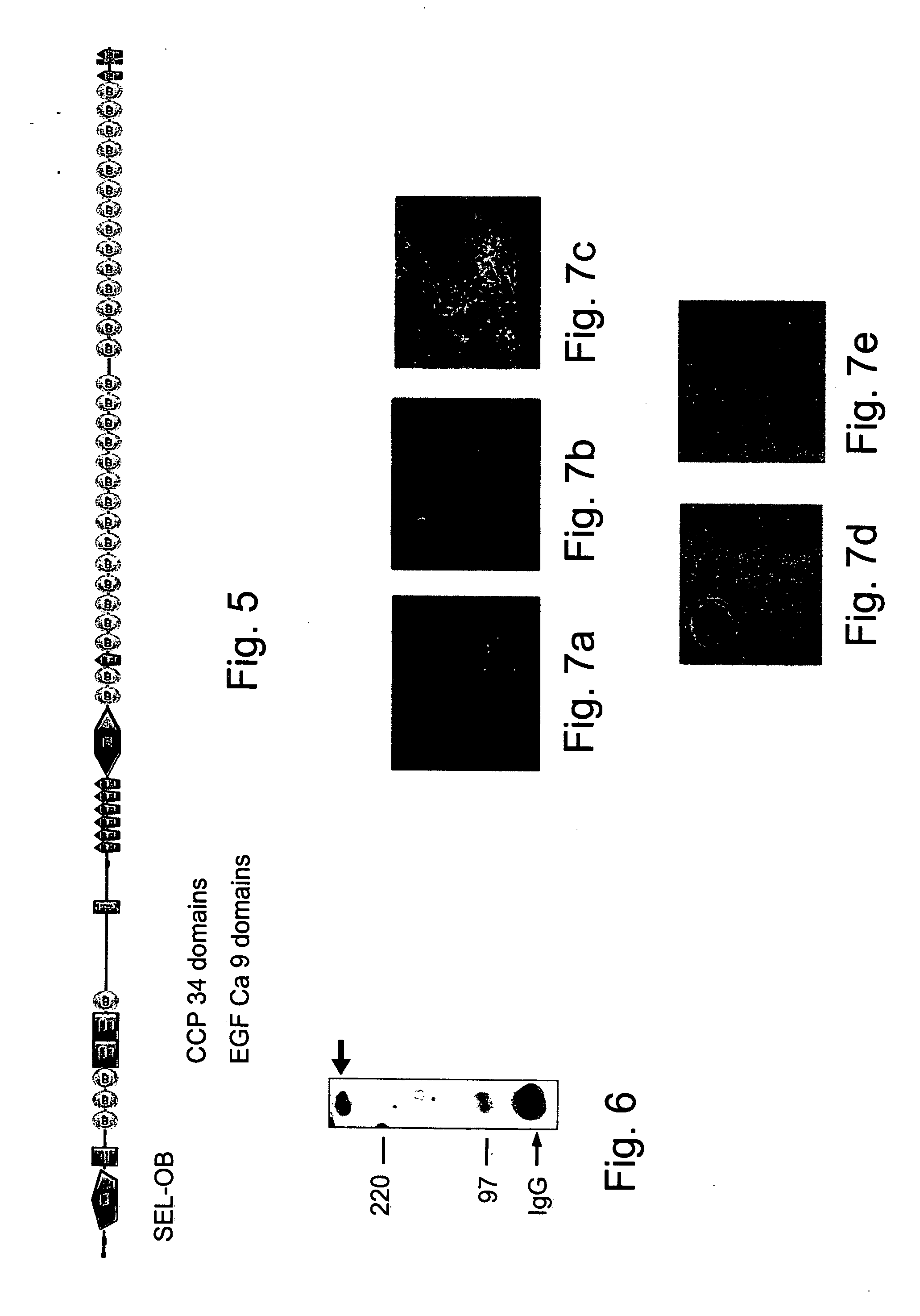 Polypeptides, polynucleotides encoding same, antibodies thereagainst and methods of using same for diagnosing and treating cancer and skeletal disorders