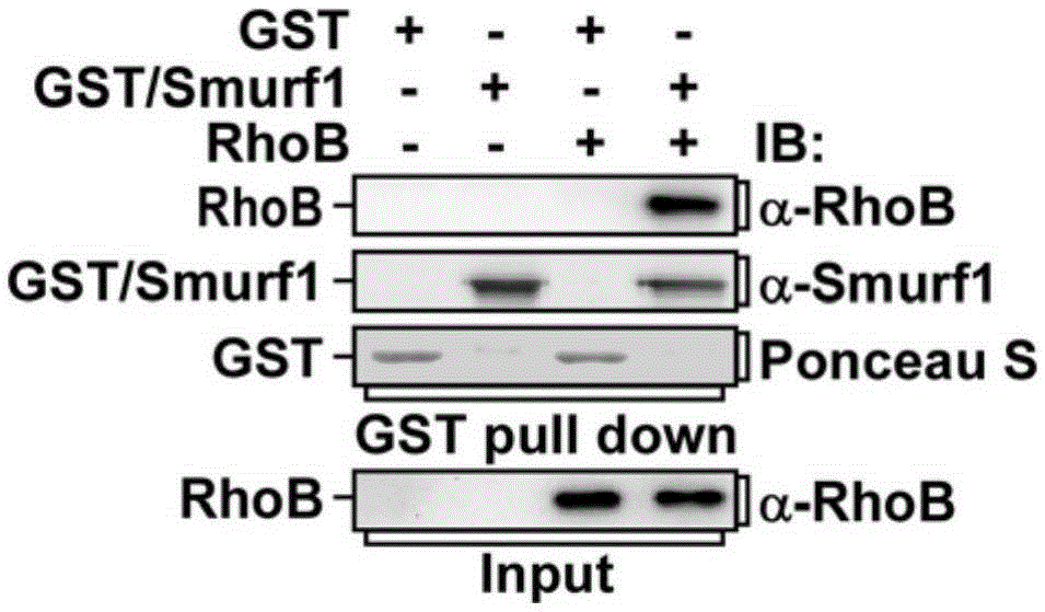 Screening method for anti-tumor drugs targeting Smurf1 ubiquitination and degradation of Rhob
