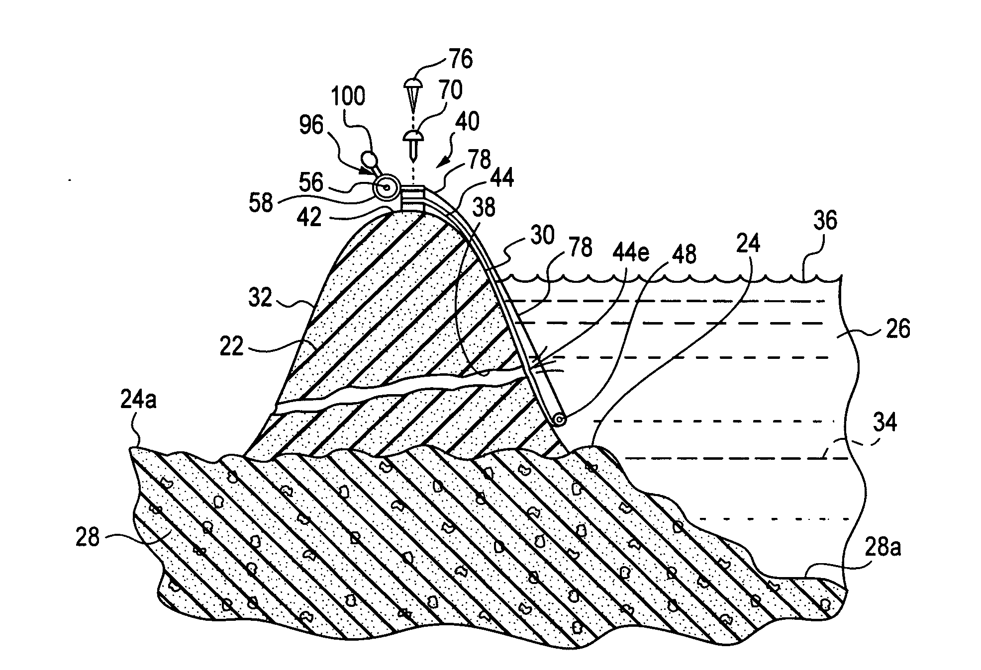 Apparatus for and methods of stabilizing a leaking dam or levee