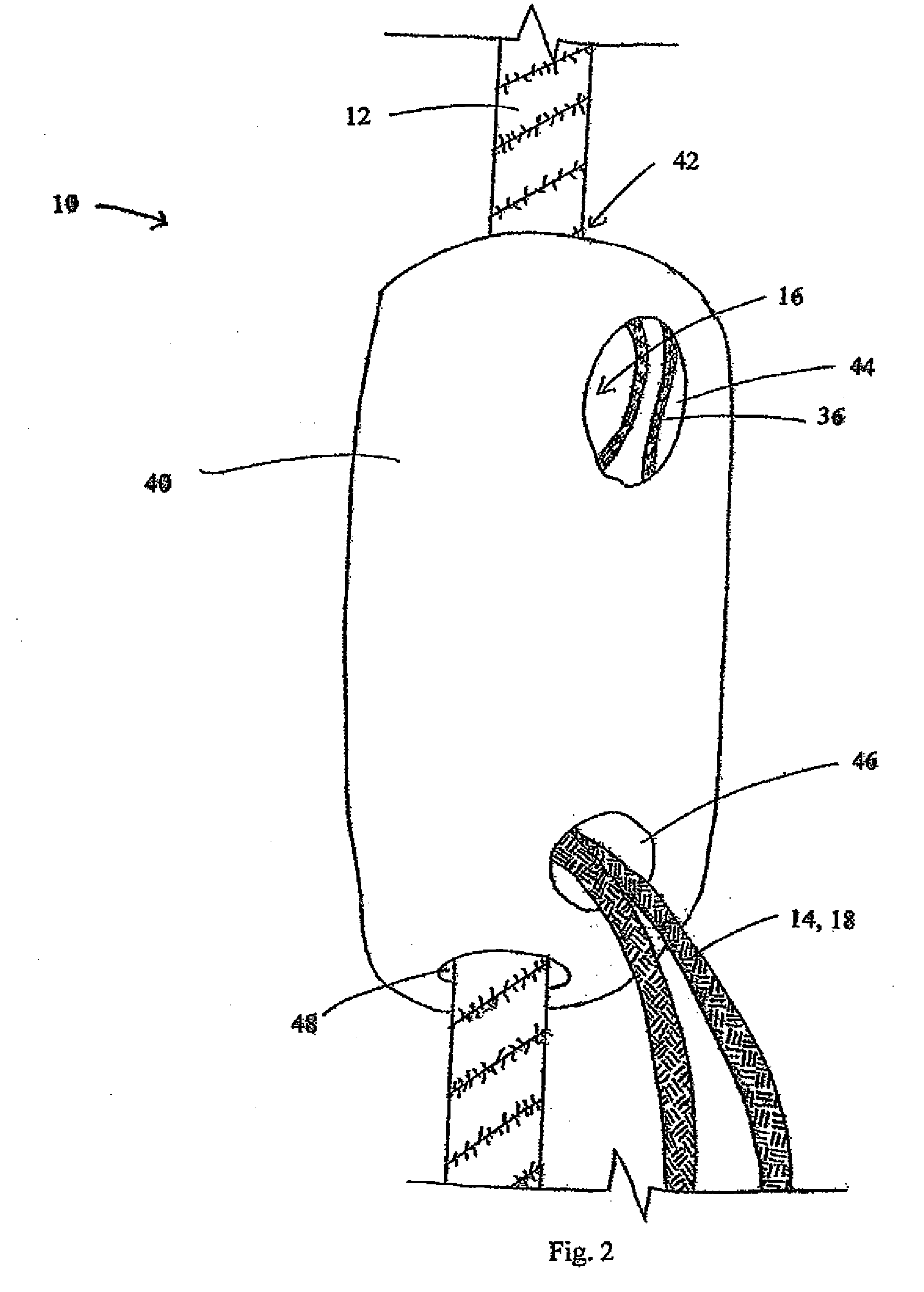 Fall Protection Apparatus with Controlled Descent