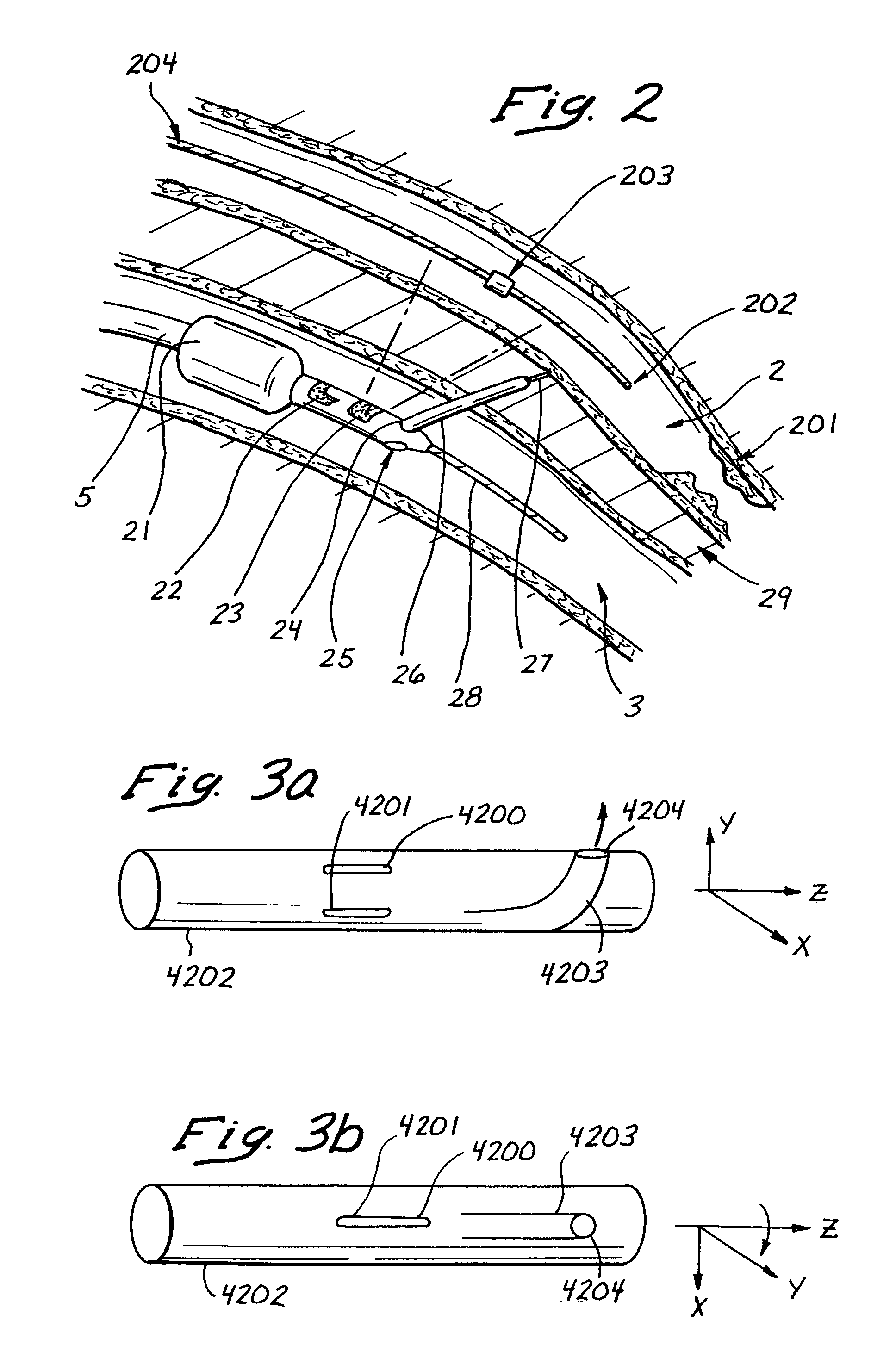 Device, system and method for interstitial transvascular intervention