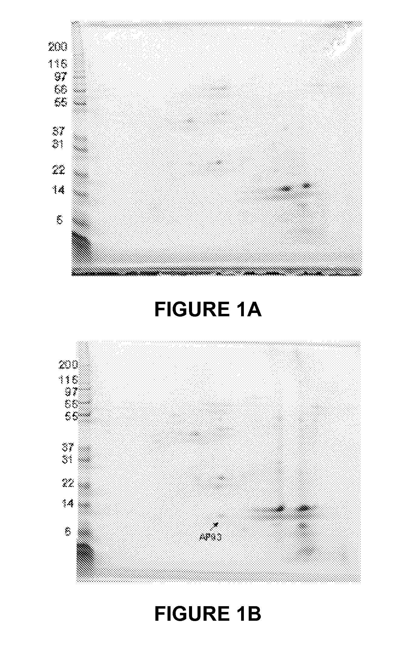 Methods and devices for diagnosis of appendicitis