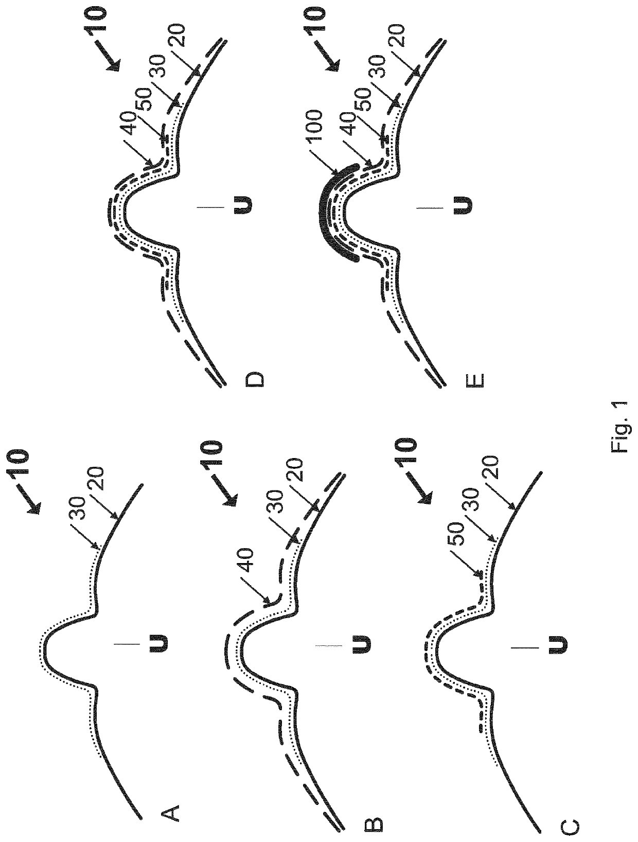 Facial interface