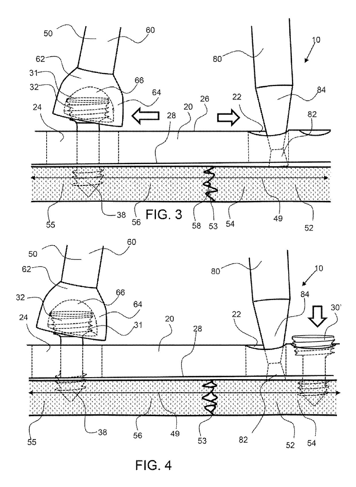 Bone manipulator system and method