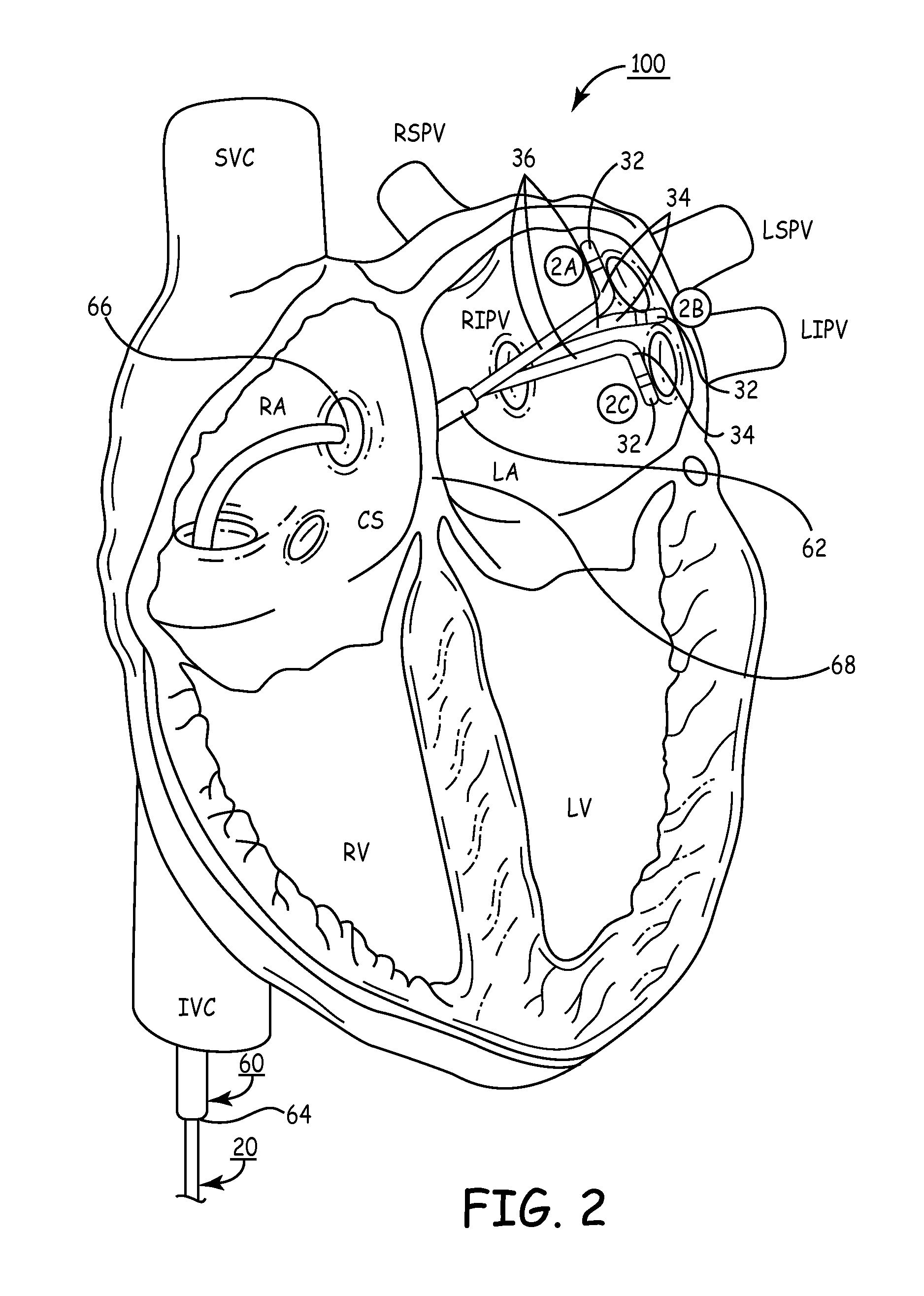 Trans-septal catheter with retention mechanism