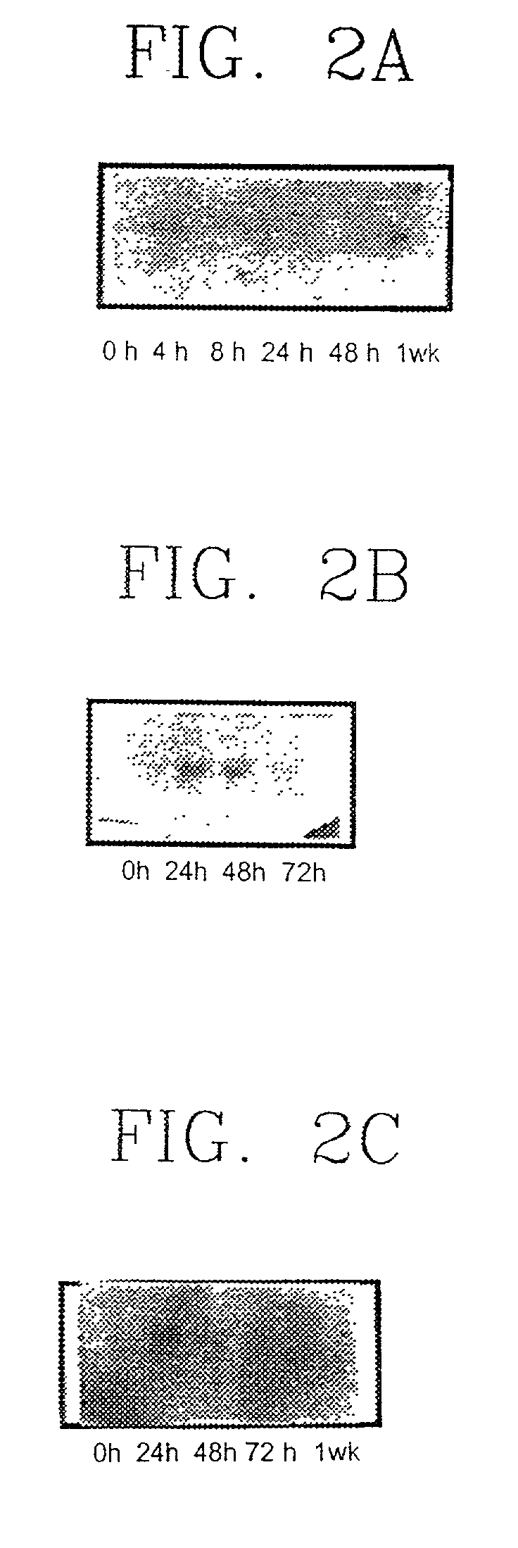 Cancer diagnosis method using cell growth inhibiting and cell differentiation specific SYG972 gene and genomic DNA and promoter thereof