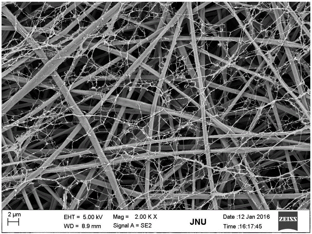 Chitin whisker/chitosan nanofiber double strengthened biodegradable polyester fiber composite material as well as preparation method and application thereof