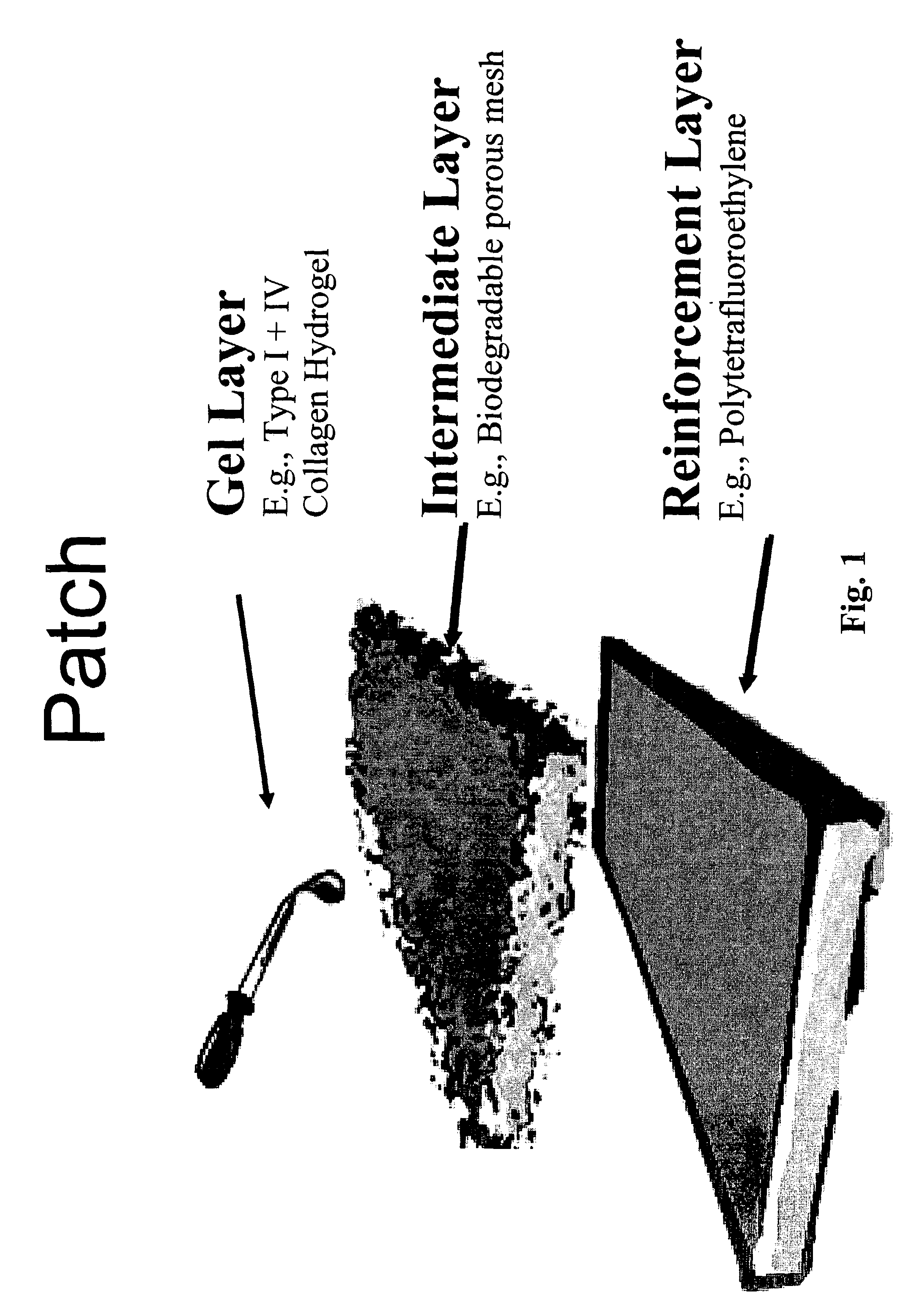 Cell delivery patch for myocardial tissue engineering