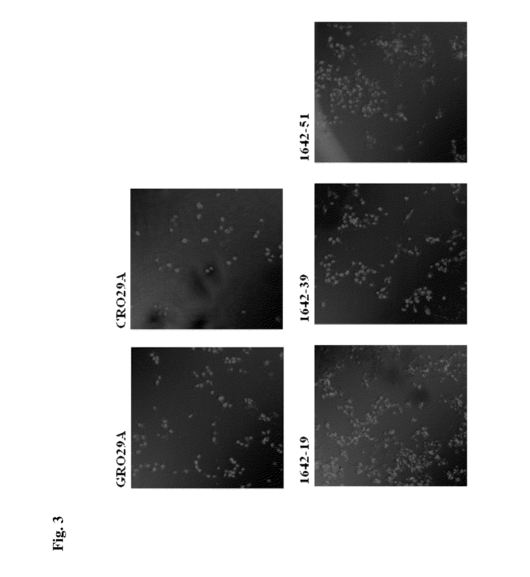 Method of diagnosing cancer using a nucleolin specific aptamer