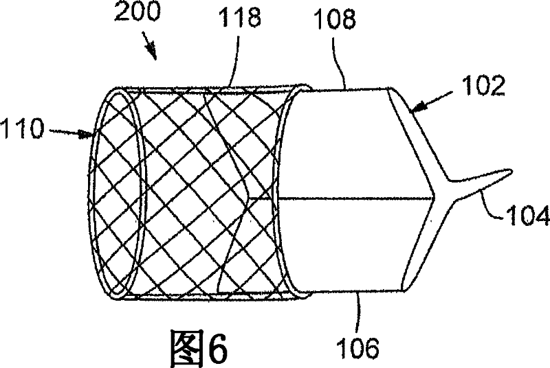 Prosthetic insert for improving heart valve function