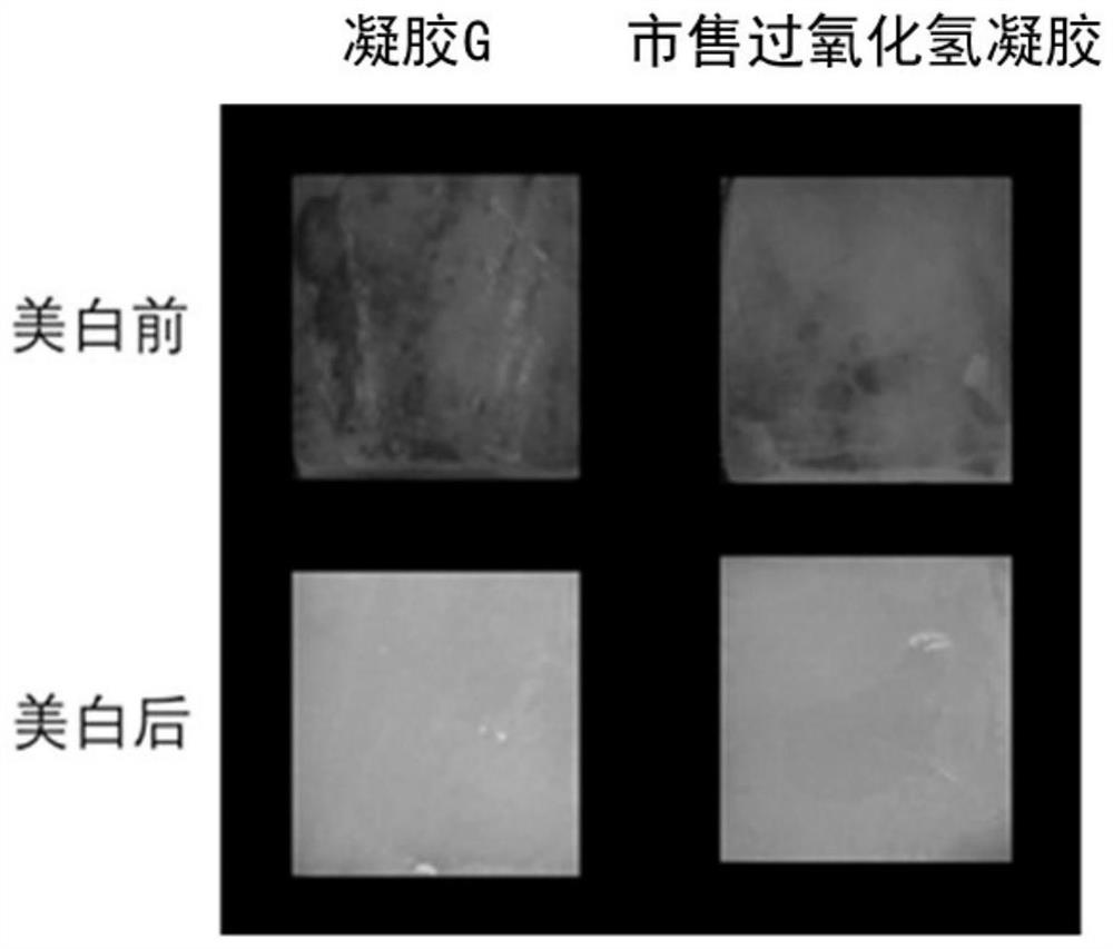 Novel tooth whitening gel and preparation method and application thereof