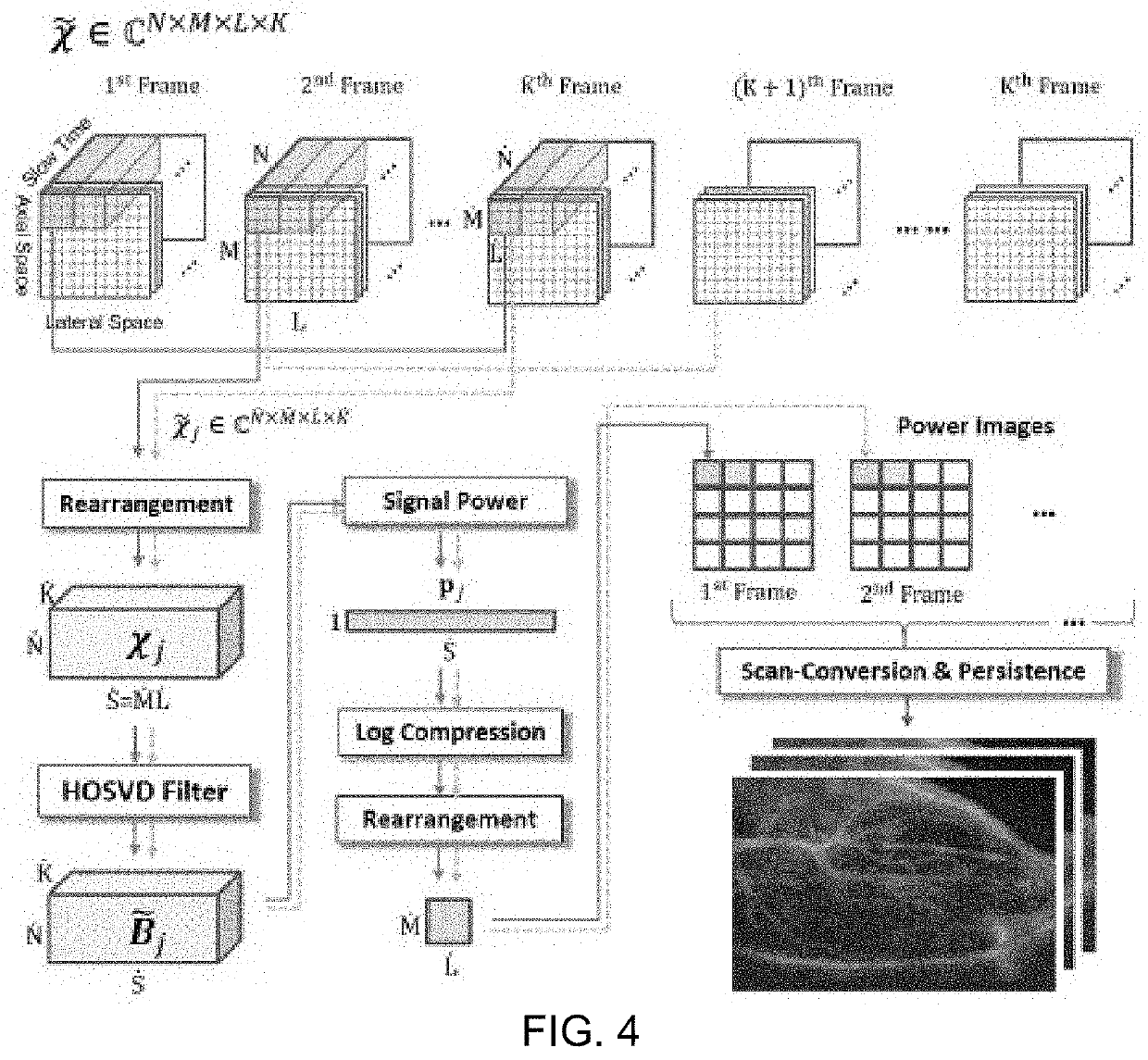 Ultrasonic imaging with clutter filtering for perfusion