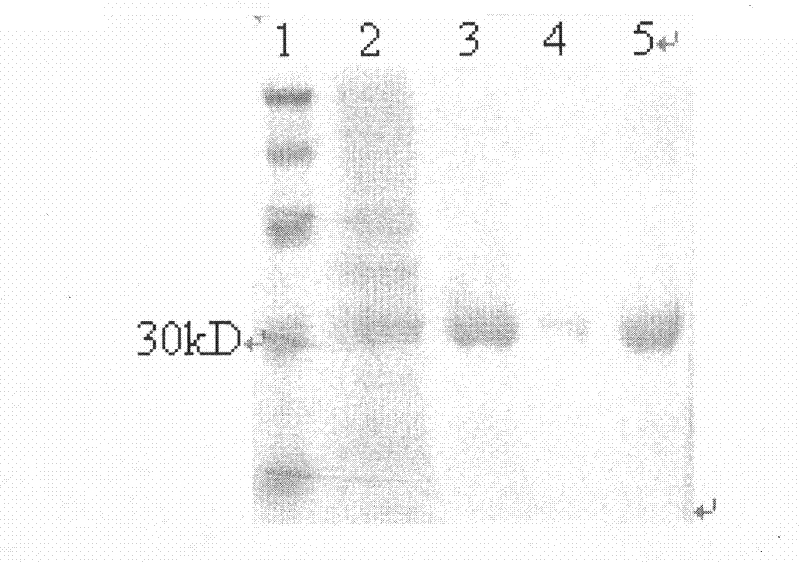 Single-chain antibody in anti-human prostate-specific membrane antigen extracellular region and application thereof