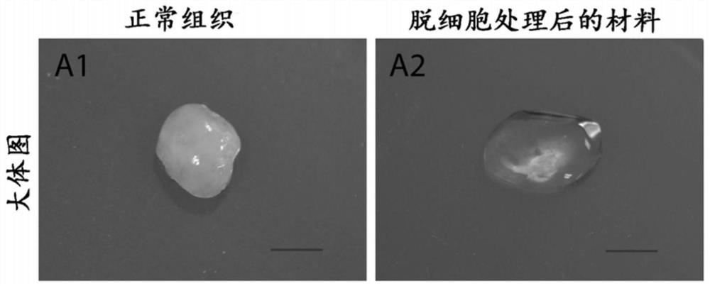 A preparation method of decellularized nucleus pulposus material derived from natural tissue