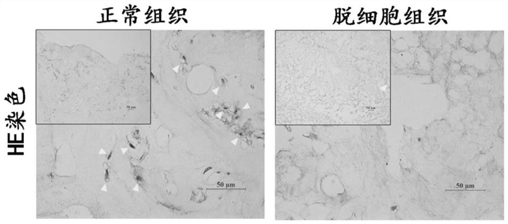 A preparation method of decellularized nucleus pulposus material derived from natural tissue