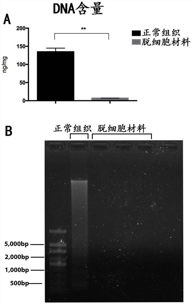 A preparation method of decellularized nucleus pulposus material derived from natural tissue