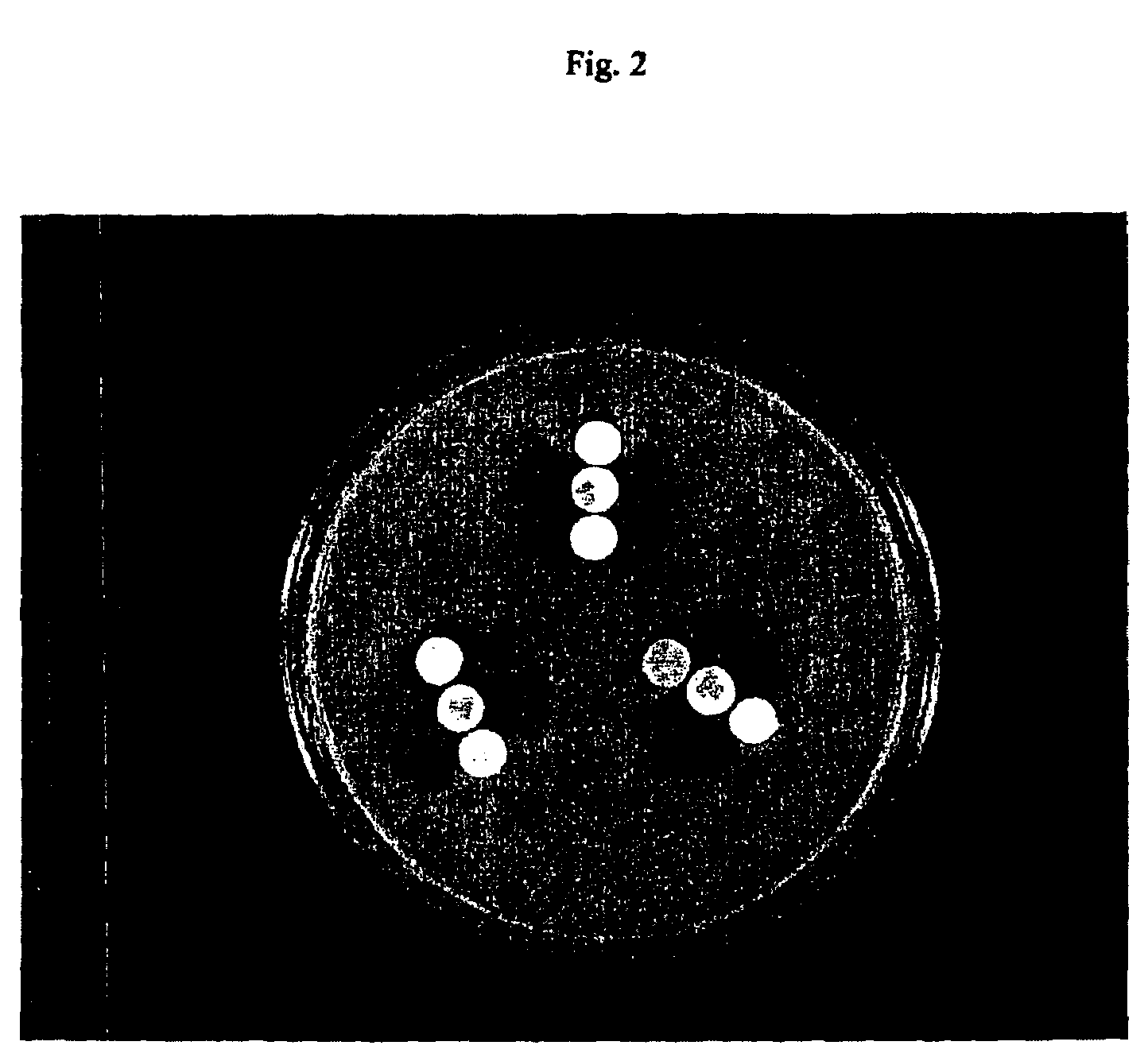 Device and method for detecting antibiotic-inactivating enzymes