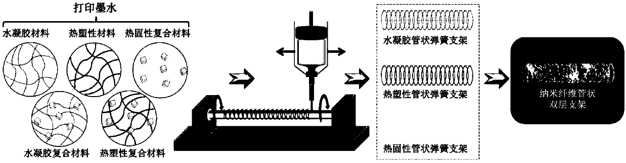 Elastic double-layer tubular tissue engineering scaffold with multistage porous structure and preparation method thereof