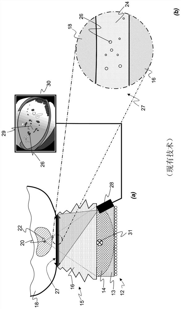 A method and apparatus for monitoring coupling quality of interface between lithotripter and patient