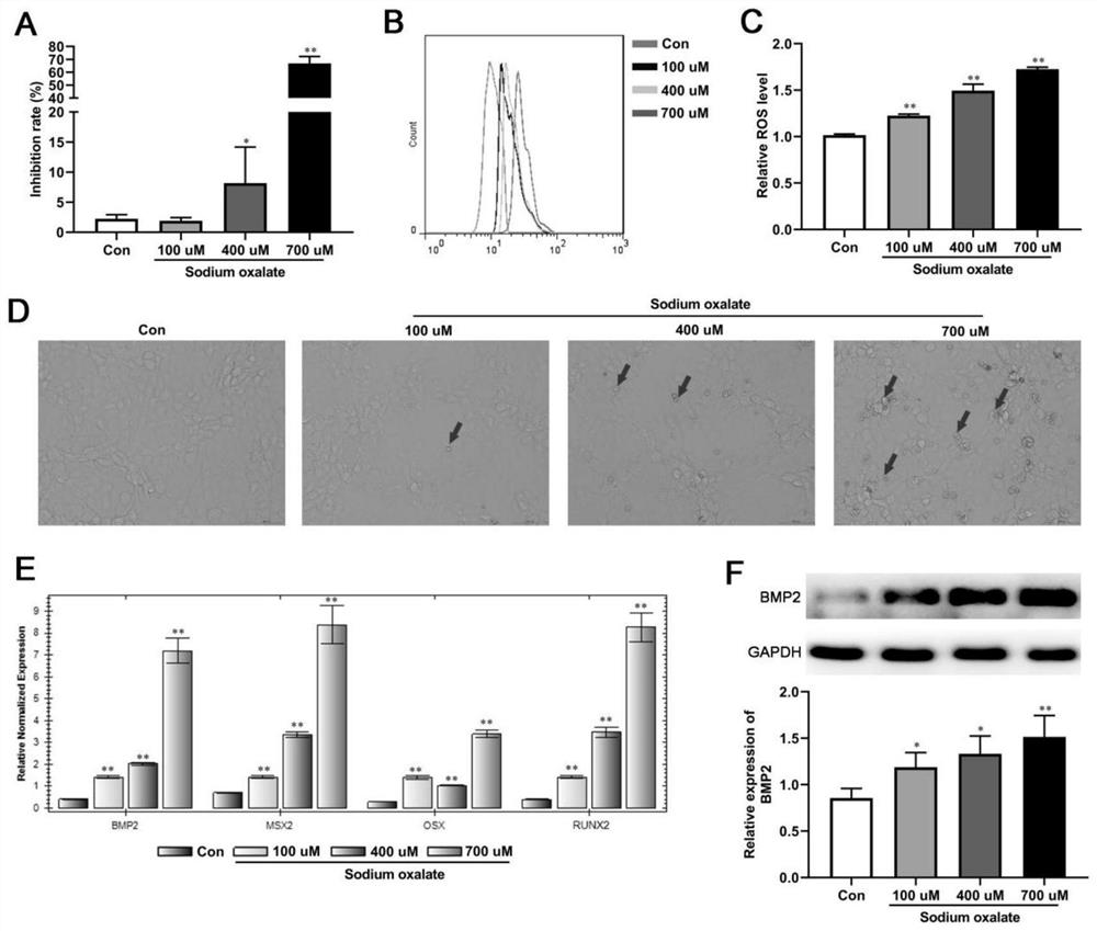 Application of mechanism of BMP2 silencing in elimination of renal calcium oxalate calculus injuries