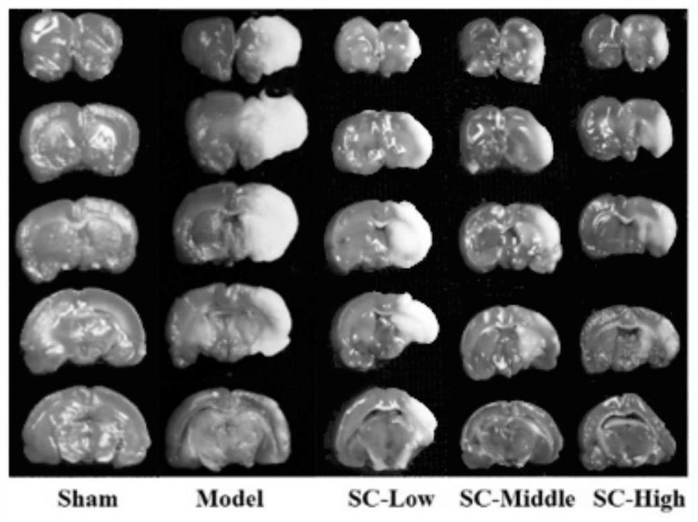 Application of scirpenin C in preparation of medicine for treating cerebral arterial thrombosis