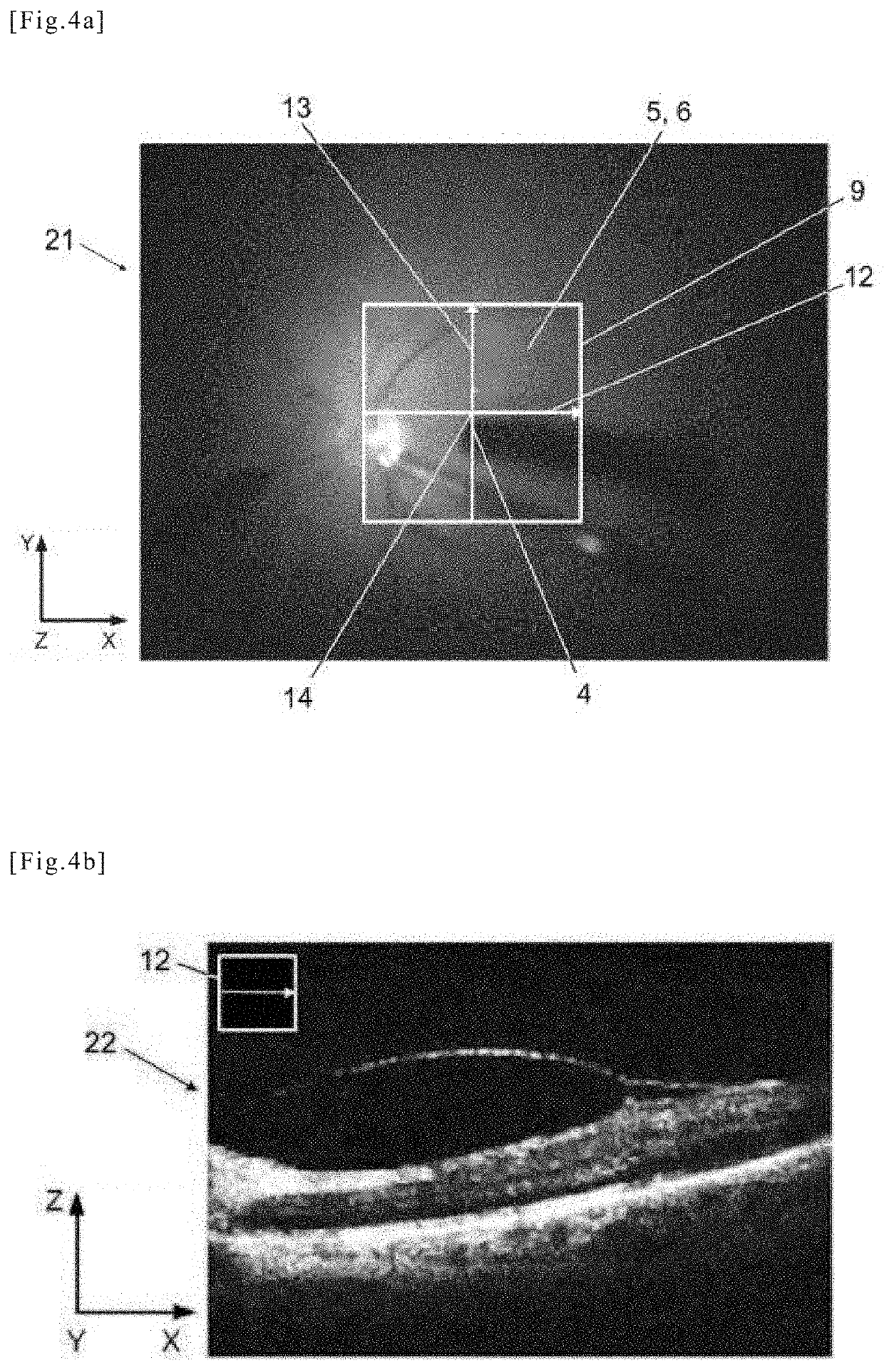 Medical device for eye surgery