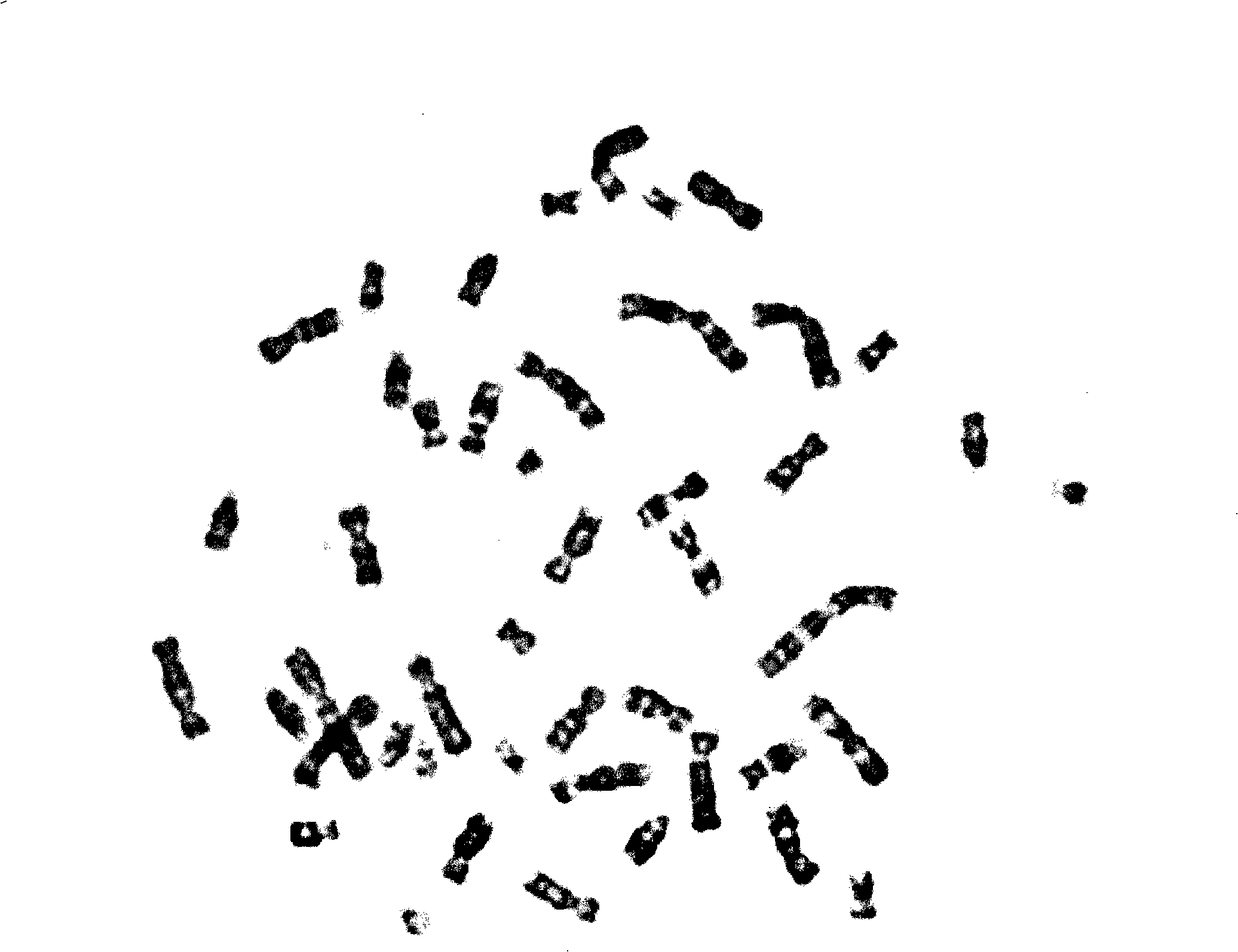 Automatic separating method for X type overlapping and adhering chromosome