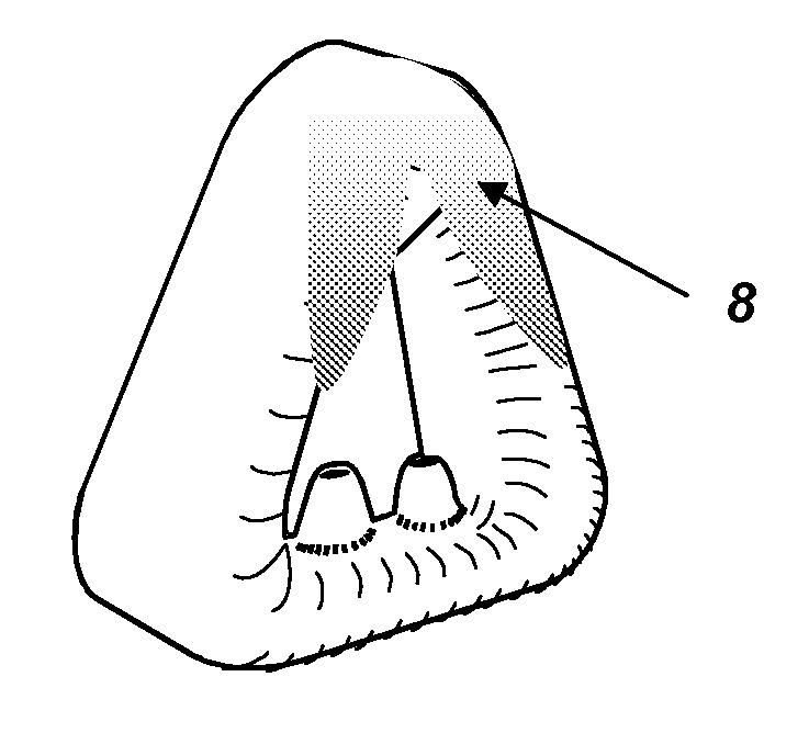 Mask System with Improved Sealing Properties for Administering Nasal Positive Airway Pressure Therapy