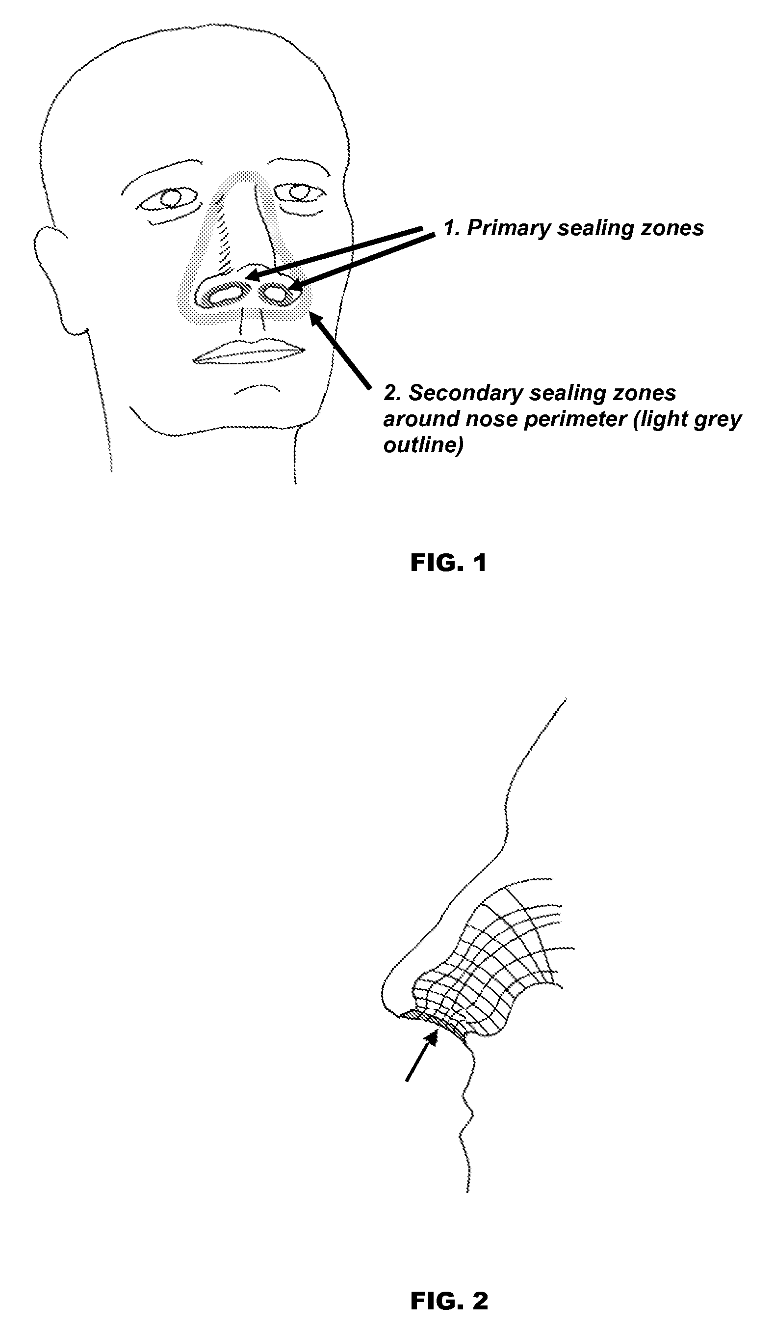 Mask System with Improved Sealing Properties for Administering Nasal Positive Airway Pressure Therapy