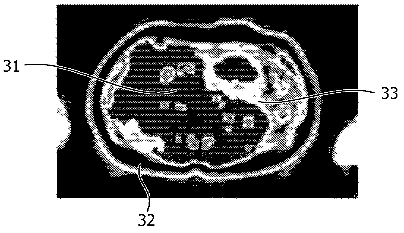 MR imaging using a multi-point dixon technique