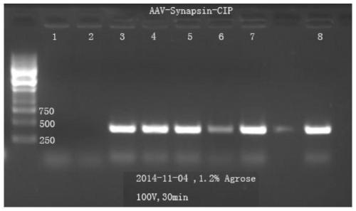 AAV9-CIP virus expressing neurodegenerative disease protective peptide and preparation method thereof