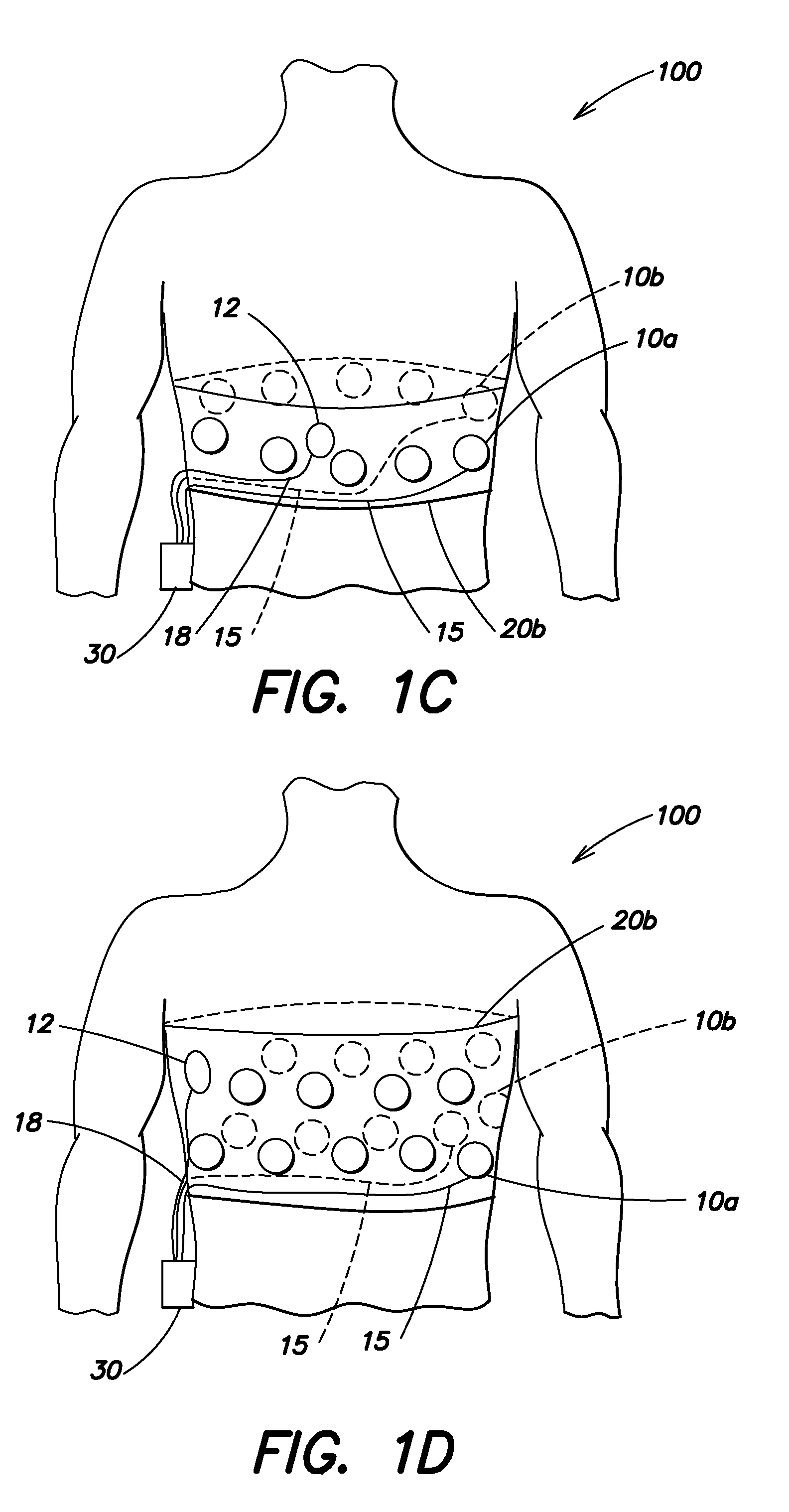 Wearable ambulatory medical device with multiple sensing electrodes