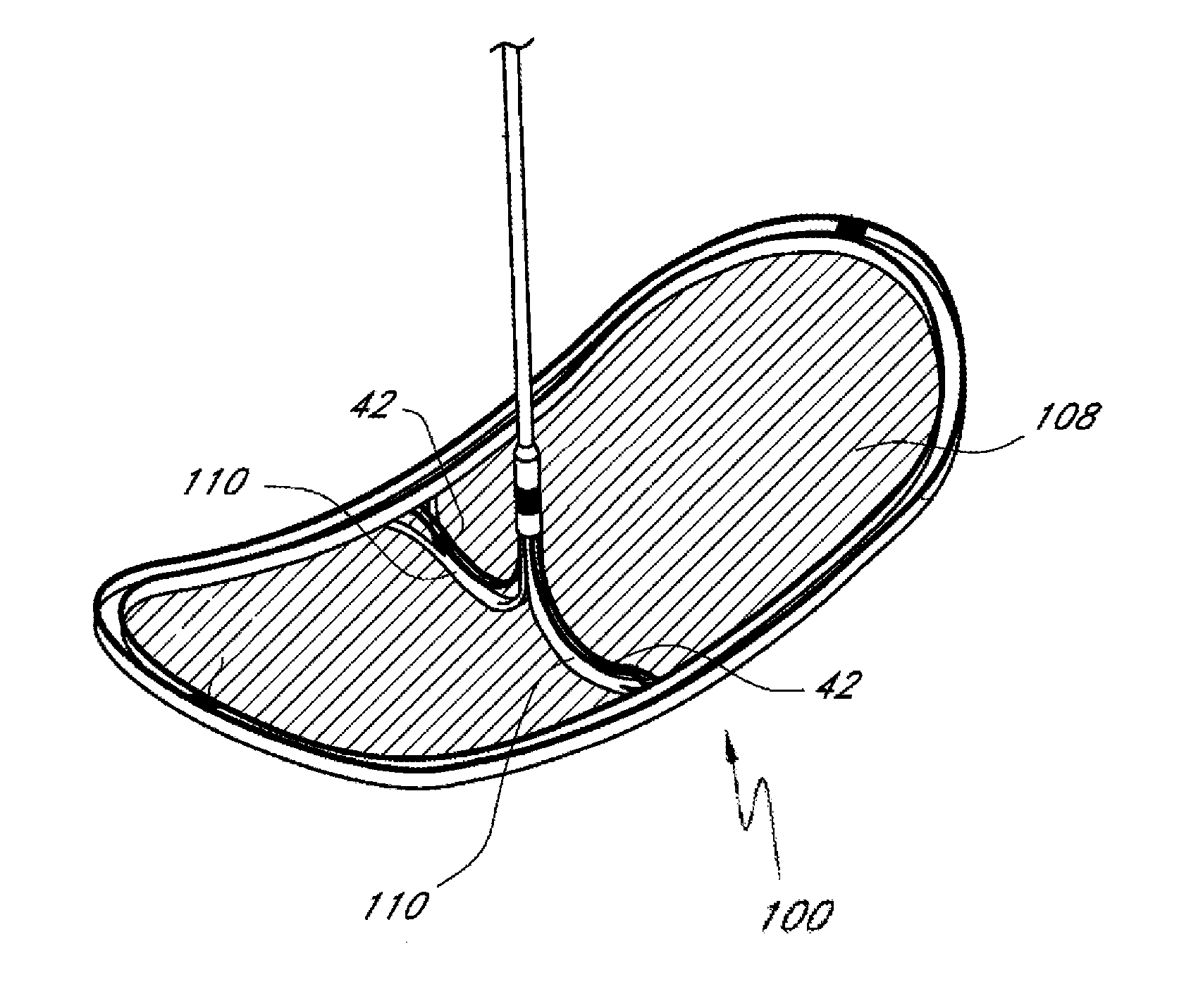 Embolic protection device and method of use